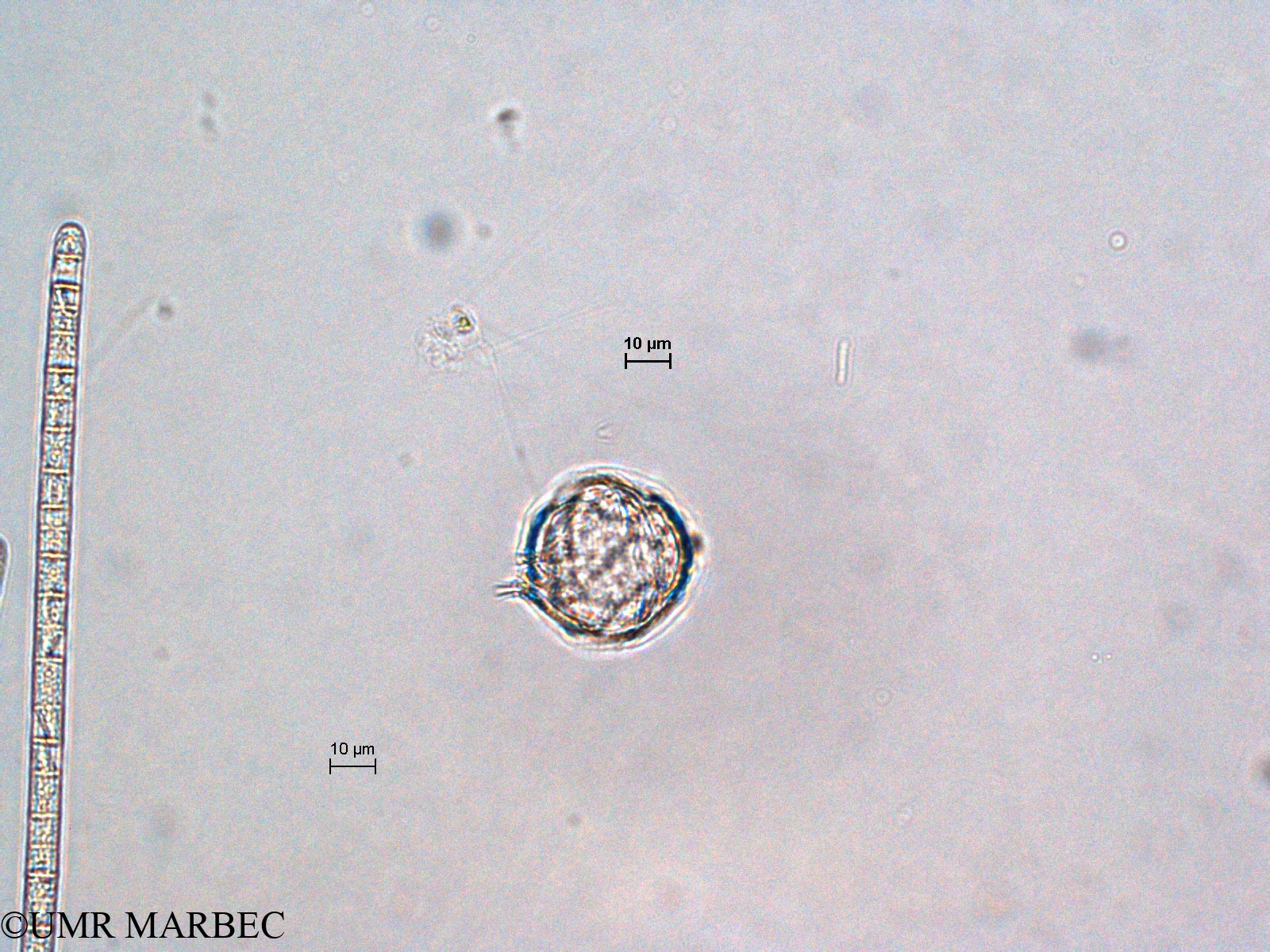 phyto/Scattered_Islands/all/COMMA April 2011/Protoperidinium sp21 (ancien Protoperidinium sp3)(copy).jpg